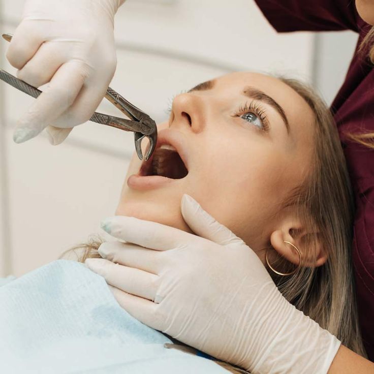 Tooth extraction treatment